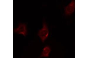 ABIN6274870 staining HepG2 by IF/ICC. (Ataxin 2 antibody  (Internal Region))