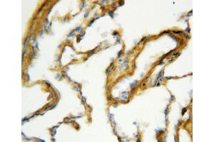 Anti-Surfactant Protein A antibody, IHC(P) IHC(P): Rat Lung Tissue (Surfactant Protein A1 antibody  (C-Term))