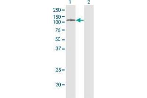 Western Blot analysis of PLD2 expression in transfected 293T cell line by PLD2 monoclonal antibody (M01), clone 1C5.