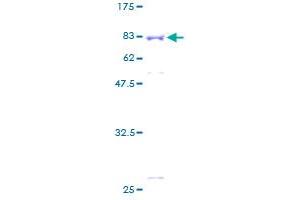 APBB3 Protein (AA 1-486) (GST tag)