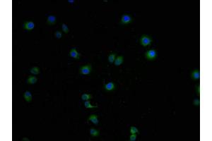 Immunofluorescence staining of A549 cells with ABIN7158014-IF at 1:100, counter-stained with DAPI. (LCMT1 antibody  (AA 157-357))