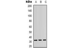Western blot analysis of CD74 expression in Ramos (A), Raji (B), PC12 (C) whole cell lysates. (CD74 antibody)