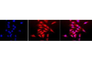 Immunocytochemistry/Immunofluorescence analysis using Rabbit Anti-SOD (Cu/Zn) Polyclonal Antibody (ABIN361651 and ABIN361652). (SOD1 antibody)