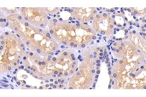 Detection of CASP8 in Human Kidney Tissue using Polyclonal Antibody to Caspase 8 (CASP8) (Caspase 8 antibody  (AA 217-384))