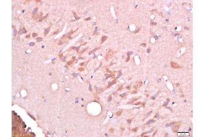 Paraformaldehyde-fixed, paraffin embedded rat brain tissue, Antigen retrieval by boiling in sodium citrate buffer(pH6) for 15min, Block endogenous peroxidase by 3% hydrogen peroxide for 30 minutes, Blocking buffer (normal goat serum) at 37°C for 20min, Antibody incubation with Rabbit Anti-CELSR3/Flamingo homolog 1 Polyclonal Antibody, Unconjugated  at 1:500 overnight at 4°C, followed by a conjugated secondary and DAB staining (CELSR3 antibody  (AA 1601-1700))