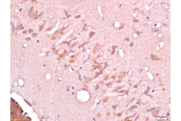 CELSR3 antibody  (AA 1601-1700)