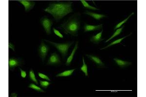 Immunofluorescence of monoclonal antibody to PRPF4B on HeLa cell. (PRPF4B antibody  (AA 898-1005))