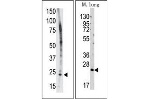 Image no. 1 for anti-BH3 Interacting Domain Death Agonist (BID) (BH3 Domain) antibody (ABIN356816) (BID antibody  (BH3 Domain))