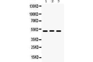 Western Blotting (WB) image for anti-Bone Morphogenetic Protein 5 (BMP5) (AA 332-365), (C-Term) antibody (ABIN3043800)