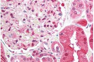 Human Kidney (formalin-fixed, paraffin-embedded) stained with BRCC3 antibody ABIN213911 at 5 ug/ml followed by biotinylated goat anti-rabbit IgG secondary antibody ABIN481713, alkaline phosphatase-streptavidin and chromogen. (BRCC3 antibody  (N-Term))
