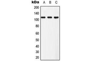 Western blot analysis of EPHB3 (pY608) expression in Hela (A), NIH3T3 (B), PC12 (C) whole cell lysates. (EPH Receptor B3 antibody  (pTyr608))