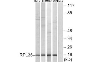 Western blot analysis of extracts from HeLa cells, Jurkat cells, COLO cells and 293 cells, using RPL35 antibody. (RPL35 antibody  (Internal Region))