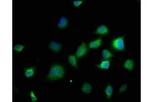 Immunofluorescence staining of SH-SY5Y cells with ABIN7150001 at 1:166, counter-stained with DAPI. (DPH5 antibody  (AA 138-235))