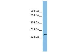 GSTK1 antibody used at 1 ug/ml to detect target protein. (GSTK1 antibody  (Middle Region))