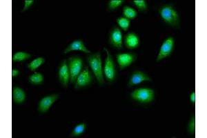 Immunofluorescence staining of A549 cells with ABIN7146392 at 1:133, counter-stained with DAPI. (PNPLA8 antibody  (AA 158-345))