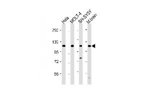 All lanes : Anti-KI Antibody (C-term) at 1:2000 dilution Lane 1: Hela whole cell lysate Lane 2: MOLT-4 whole cell lysate Lane 3: SH-SY5Y whole cell lysate Lane 4: Mouse brain lysate Lysates/proteins at 20 μg per lane.