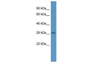 Mouse Thymus; WB Suggested Anti-C030019I05Rik Antibody. (FNDC9 antibody  (N-Term))