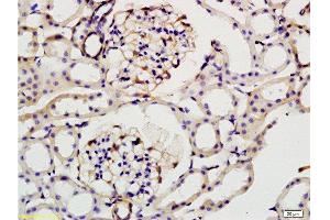 Formalin-fixed and paraffin embedded: rat kidney tissue labeled with Anti-ILK-1 Polyclonal Antibody , Unconjugated at 1:200, followed by conjugation to the secondary antibody and DAB staining (ILK antibody  (AA 301-400))