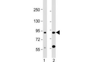 Western blot testing of human 1) brain and 2) HL-60 cell lysate with CCDC144A antibody at 1:2000. (CCDC144A antibody  (AA 1257-1289))