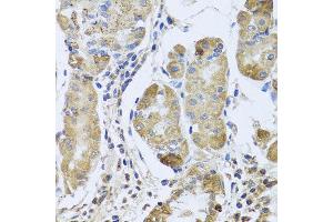 Immunohistochemistry of paraffin-embedded human gastric using EFHC1 antibody at dilution of 1:100 (x40 lens). (EFHC1 antibody)
