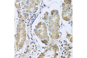 Immunohistochemistry of paraffin-embedded human gastric using EFHC1 antibody at dilution of 1:100 (x40 lens). (EFHC1 antibody)