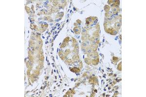 Immunohistochemistry of paraffin-embedded human gastric using EFHC1 antibody at dilution of 1:100 (x40 lens).