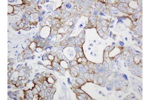 Image no. 2 for anti-ATP-Binding Cassette, Sub-Family B (MDR/TAP), Member 1 (ABCB1) (AA 995-1280) antibody (ABIN1491725) (ABCB1 antibody  (AA 995-1280))