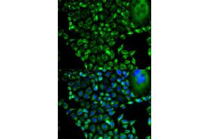 Immunofluorescence (IF) image for anti-Proteasome (Prosome, Macropain) 26S Subunit, Non-ATPase, 10 (PSMD10) antibody (ABIN1874388)