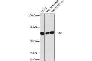 Western blot analysis of extracts of various cell lines, using CD4 antibody (ABIN3022124, ABIN3022125, ABIN3022126 and ABIN6218611) at 1:1000 dilution. (CD4 antibody  (AA 300-400))