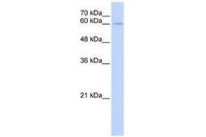 Image no. 1 for anti-Interleukin 22 Receptor, alpha 1 (IL22RA1) (C-Term) antibody (ABIN6743529) (IL22 Receptor alpha 1 antibody  (C-Term))