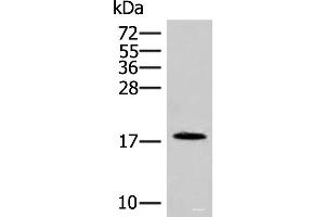 Western blot analysis of Human spleen tissue lysate using NHP2 Polyclonal Antibody at dilution of 1:400