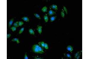 Immunofluorescent analysis of A549 cells using ABIN7175212 at dilution of 1:100 and Alexa Fluor 488-congugated AffiniPure Goat Anti-Rabbit IgG(H+L) (ATP6VA1 (AA 80-260), (Isoform 1) antibody)
