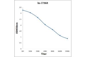 Antigen: 0. (ASB3 antibody  (AA 21-120))