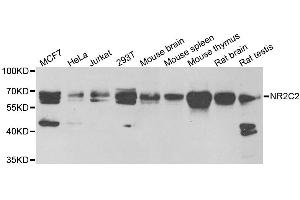 Western blot analysis of extracts of various cell lines, using NR2C2 antibody. (TR4 antibody)