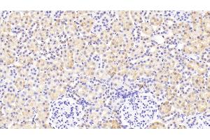 Detection of LZM in Rat Kidney Tissue using Polyclonal Antibody to Lysozyme (LZM) (LYZ antibody  (AA 19-148))