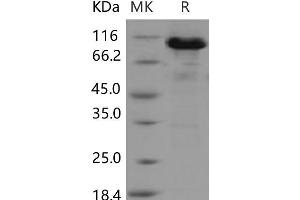 ACO2 Protein (GST tag,His tag)
