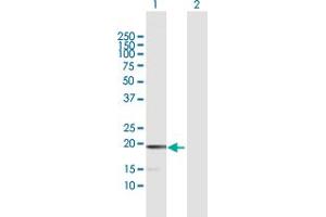 Western Blot analysis of MCEE expression in transfected 293T cell line by MCEE MaxPab polyclonal antibody.