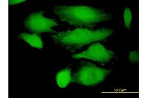 Immunofluorescence of purified MaxPab antibody to TRIM21 on HeLa cell.