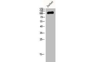 Western Blot analysis of Jurkat cells using JIK Polyclonal Antibody (TAO Kinase 3 antibody  (Internal Region))
