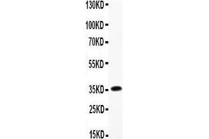 Western Blotting (WB) image for anti-CD68 Molecule (CD68) (AA 312-326), (Middle Region) antibody (ABIN3044428) (CD68 antibody  (Middle Region))