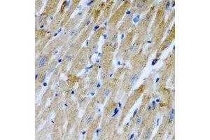 Immunohistochemical analysis of RCN2 staining in rat heart formalin fixed paraffin embedded tissue section. (RCN2 antibody)