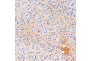 Immunohistochemistry of paraffin-embedded mouse liver using E-Cadherin antibody  at dilution of 1:100 (40x lens). (E-cadherin antibody)