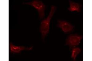ABIN6275699 staining 293 by IF/ICC. (SLC39A7 antibody  (Internal Region))