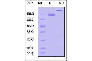 Biotinylated Human LILRB1, Fc,Avitag on  under reducing (R) and ing (NR) conditions. (LILRB1 Protein (AA 24-458) (Fc Tag,AVI tag,Biotin))