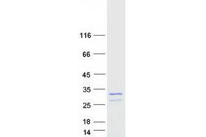 Validation with Western Blot (MIS12 Protein (Myc-DYKDDDDK Tag))
