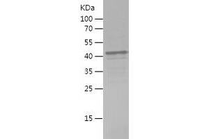Werner syndrome RecQ like helicase (WRN) (AA 1224-1432) protein (His-IF2DI Tag)