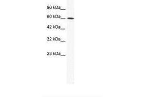 Image no. 1 for anti-Iroquois Homeobox Protein 1 (IRX1) (AA 123-172) antibody (ABIN202627) (IRX1 antibody  (AA 123-172))