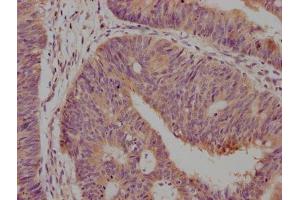 Immunohistochemistry (IHC) image for anti-CD63 (CD63) (AA 103-203) antibody (ABIN7147175)