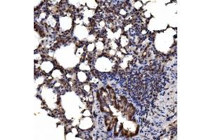 IHC analysis of delta 1 Catenin/CAS/CTNND1 using anti-delta 1 Catenin/CAS/CTNND1 antibody (ABIN7602221). (CTNND1 antibody  (AA 64-930))
