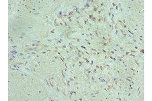 Immunohistochemistry of paraffin-embedded human gallbladder tissue using ABIN7150716 at dilution of 1:100 (MAP2K5 antibody  (AA 1-190))
